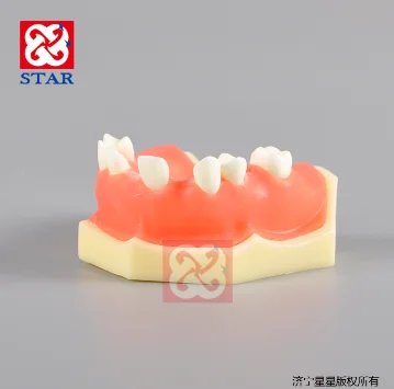 Sinus lift practice model implant model