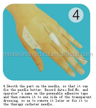 
transparent i.v catheter dressing 