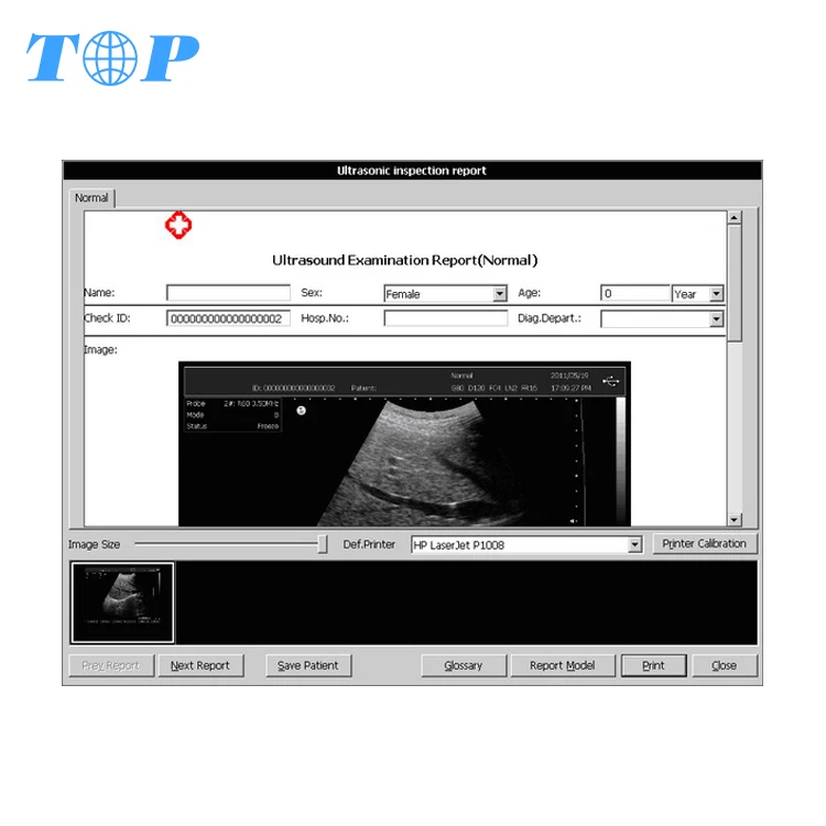 TOP-A1064 Touch Screen Trolley Ultrasound Price Diagnosis B Scanner