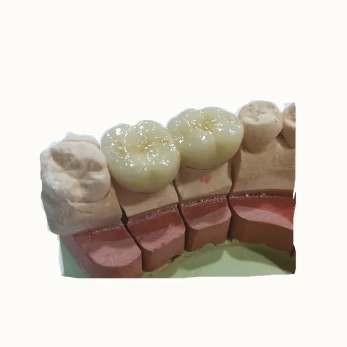 
Good metal and porcelain false teeth 