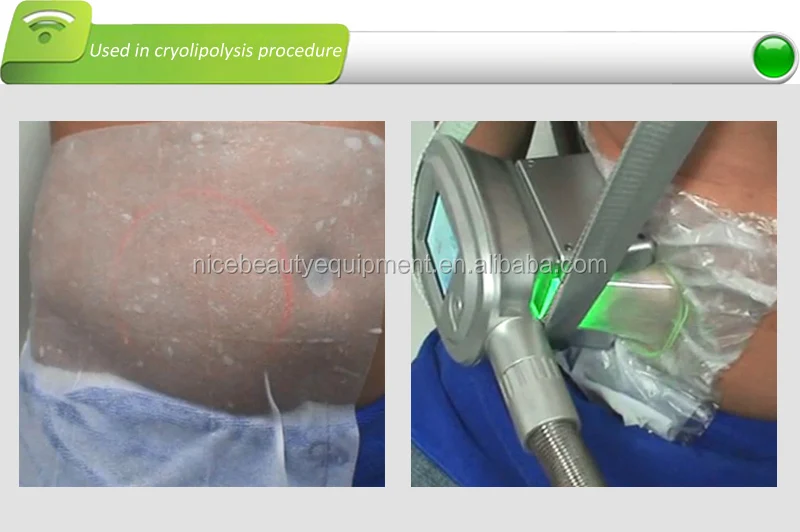 Professional Fat Freeze  Antifreezing Membranes 60g,70g,110g