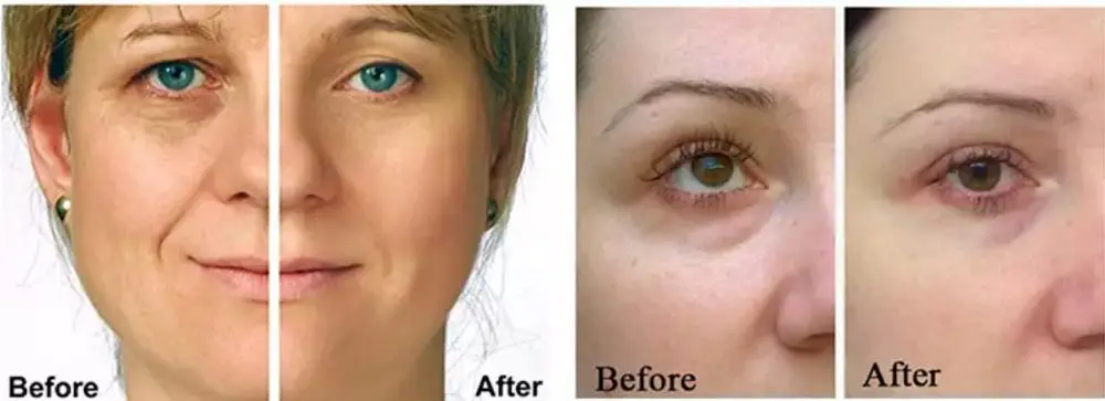 Skin Care Private Label Organic Face OEM Anti Aging Pure Vitamin C Serum Hyaluronic Acid