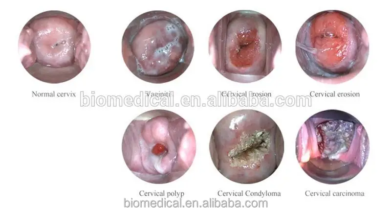 
Video Colposcope Manufacturers Colposcope Leisegang Medical 
