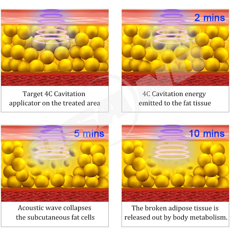 Best products osano double shape vacuum roller rf ultrasonic cavitation slimming machine