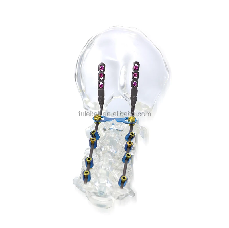 
Cervical fusion cage 