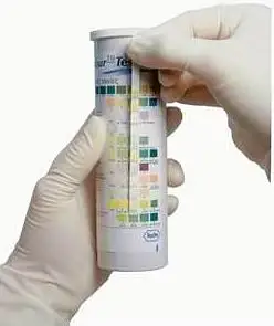 
rapid urine test strips URS-10A chemistry check urine 