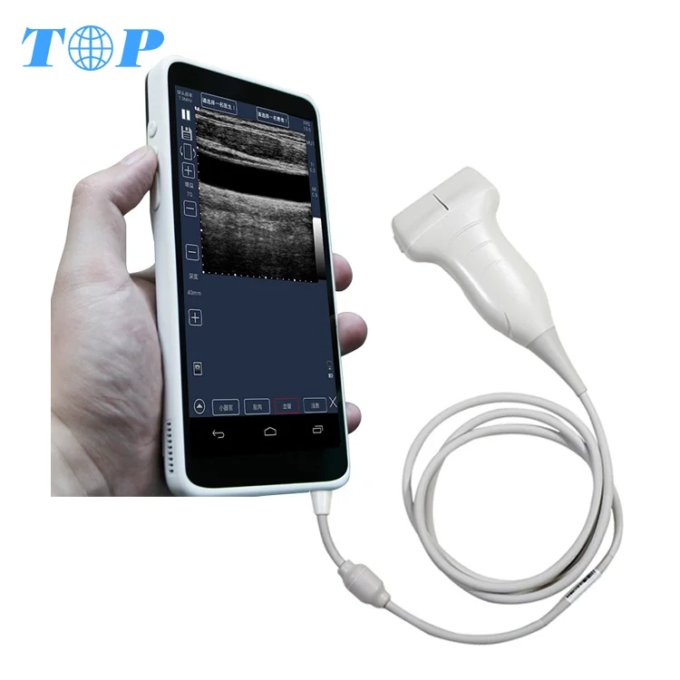 TOP-A1025 portable 4d color doppler ultrasound scanner system usb