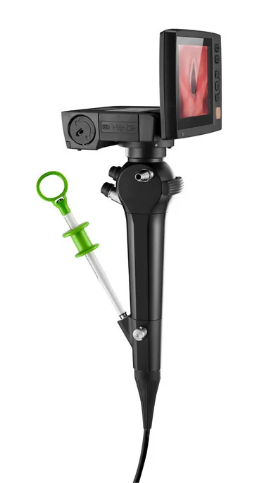 Portable flexible video endoscope compare bronchoscope