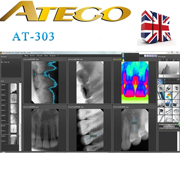 ATECO  digital  x  ray  sensor  dental  rvg  made  in  UK