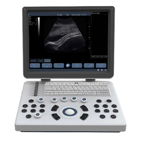MSLPU33  portable cheap B/W ultrasound machine/ultrasound scanner for clinic
