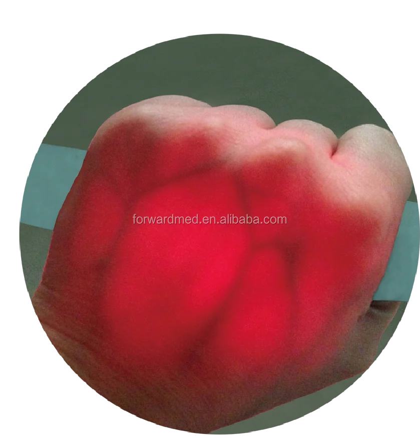 Портативный инфракрасный локатор венозных сосудистых звездочек