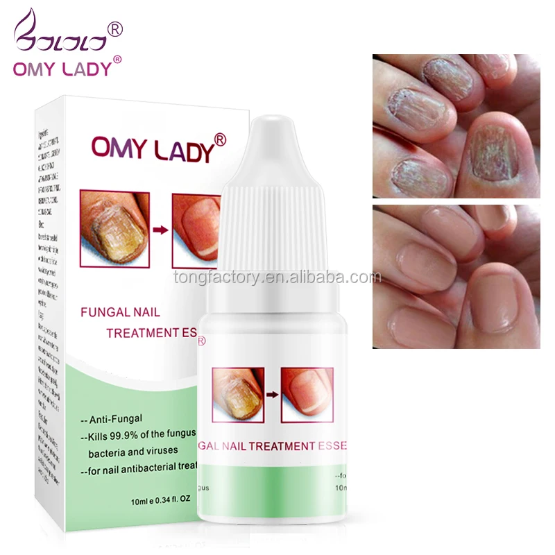 Nail Repairing OMY LADY Medical Certificated Anti Fungal Nail Solution