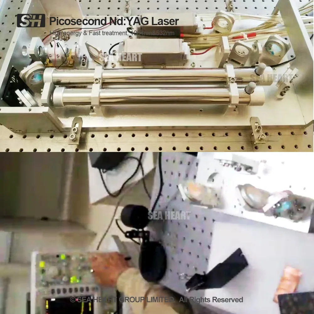  Высокоэффективный лазер nd yag нм Лазерный Аппарат для удаления