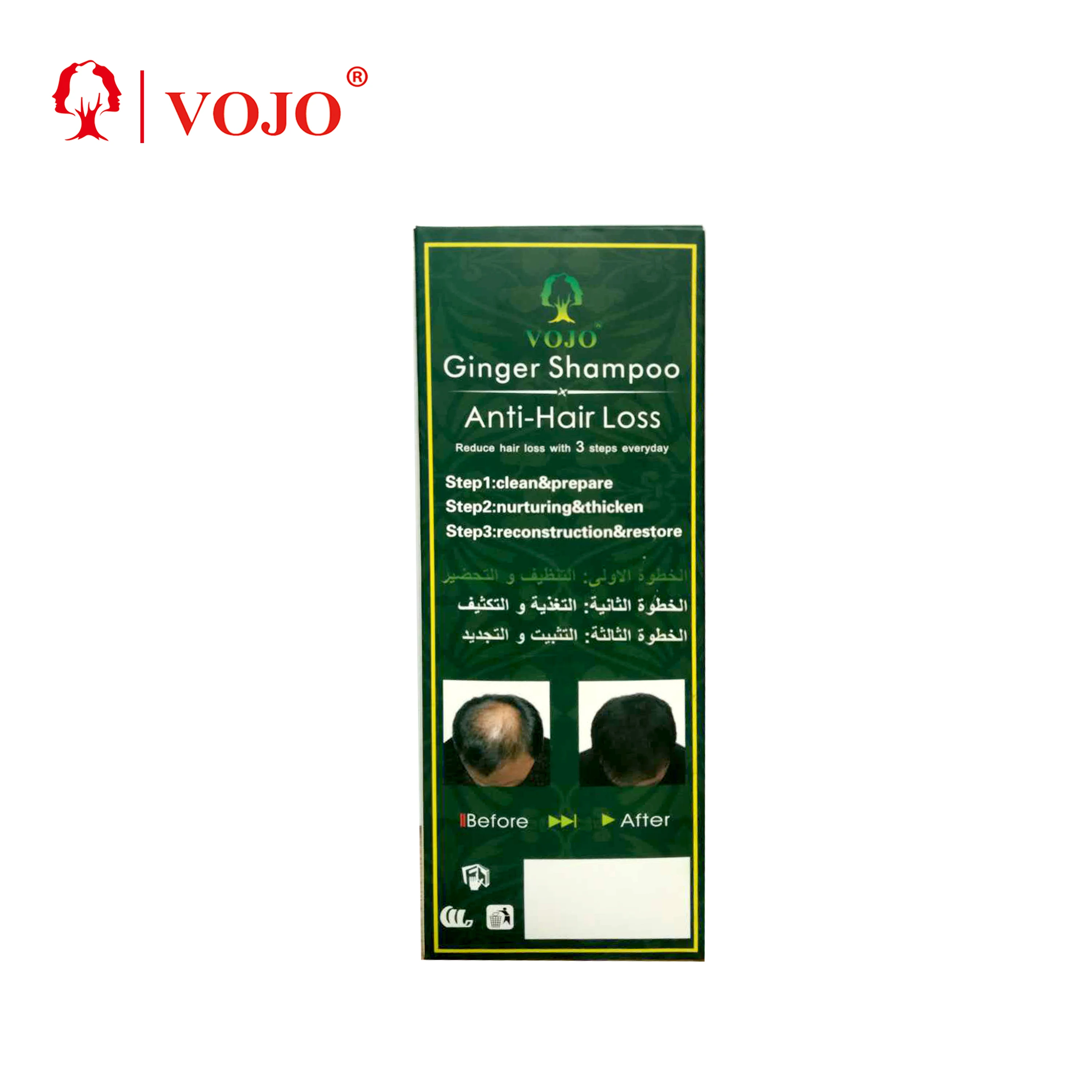 100% Natural Ginger Oil Anti Hair Loss Germinal 7 Days Fast Growth Moisturizing Conservation Hair Growth Oil