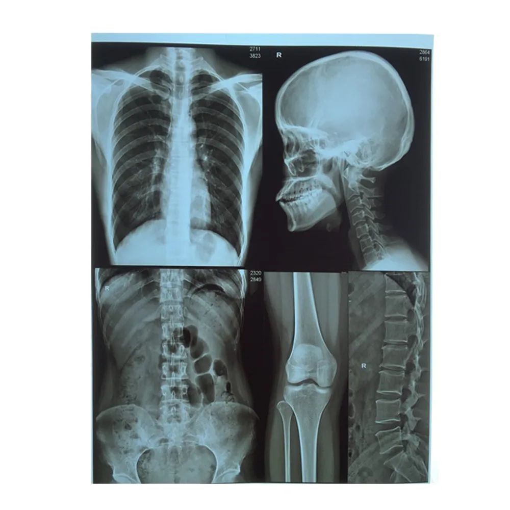 
Hospital radiology department blue color x-ray films Korea market 