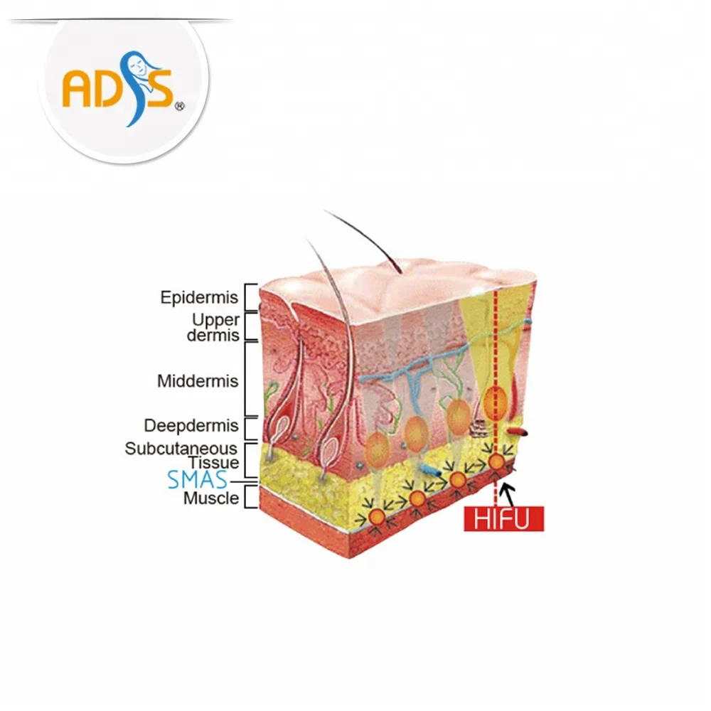 ADSS HIFU face lift machine portable HIFU for sale