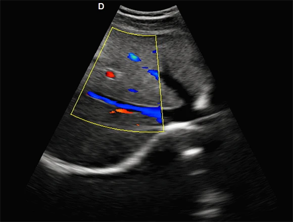portable vascular doppler & color ultrasound doppler system DW-L3