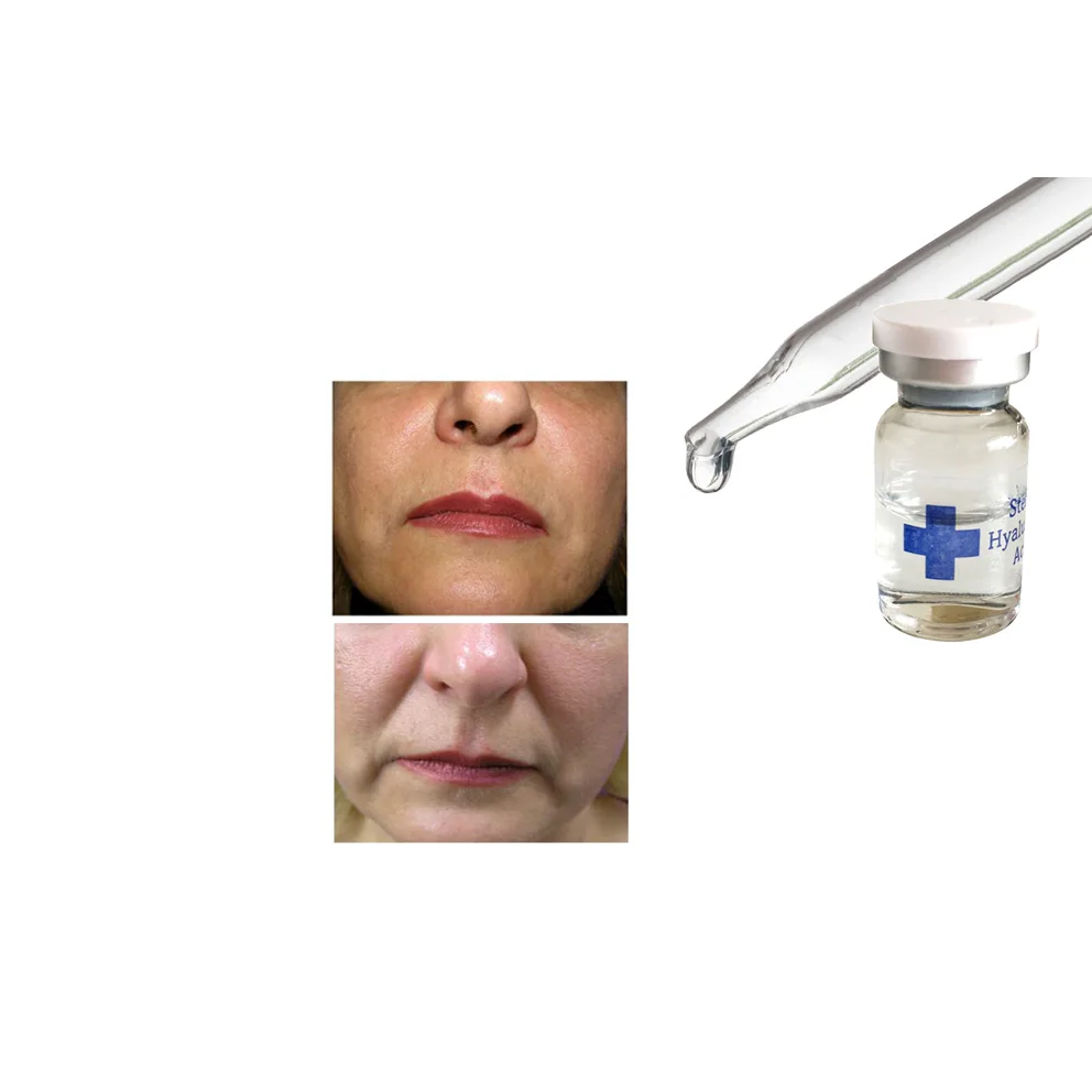 
injectable mesotherapy ha injection for skin lightening 