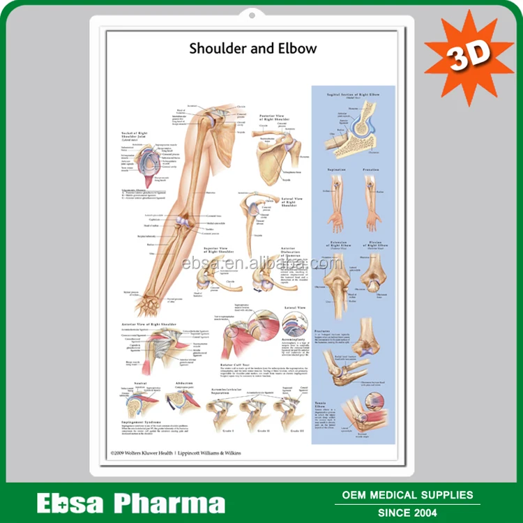 Educational Plastic 3D Medical Anatomical Wall Chart - Understanding Arthritis