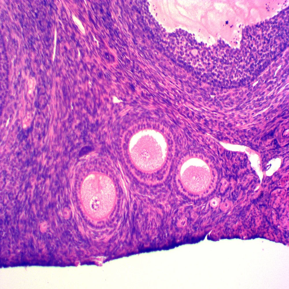Teaching resources Medical science histology prepared microscope slides/Ovary of Rabbit sec histology prepared slides