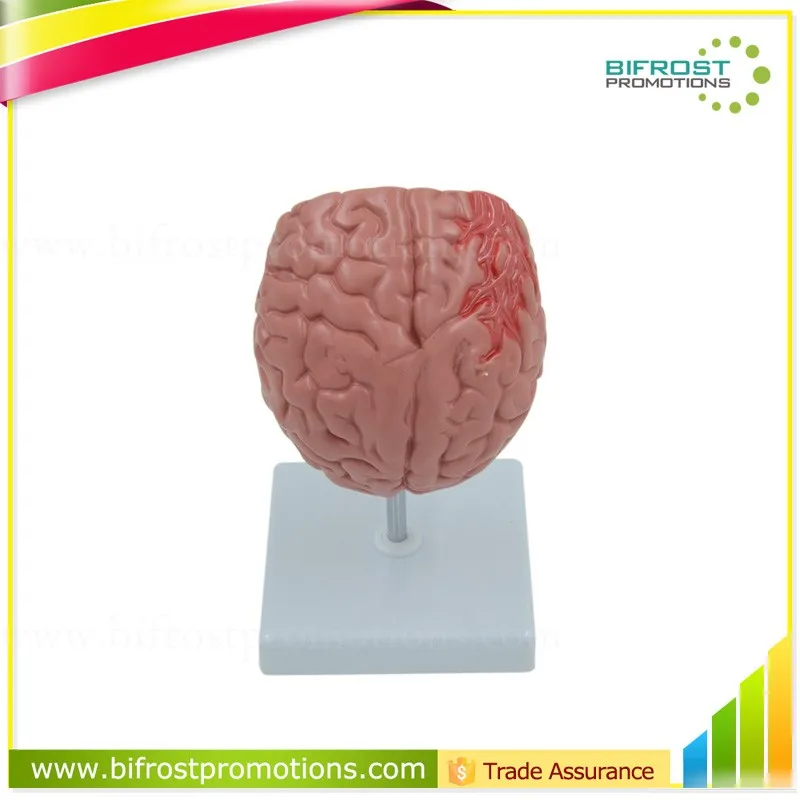 Organs Human Body Anatomy Brain Model Of Stroke