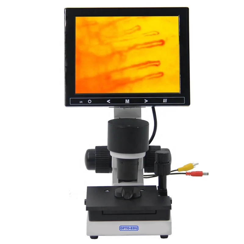 OPTO-EDU A33.0220 8' LCD Noninvasive Nail Microcirculation Checking Microscope