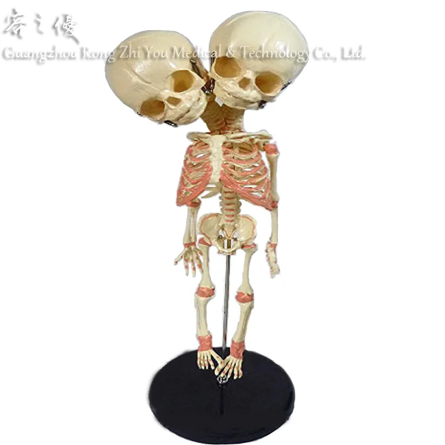 Fetal Skeleton With Stand