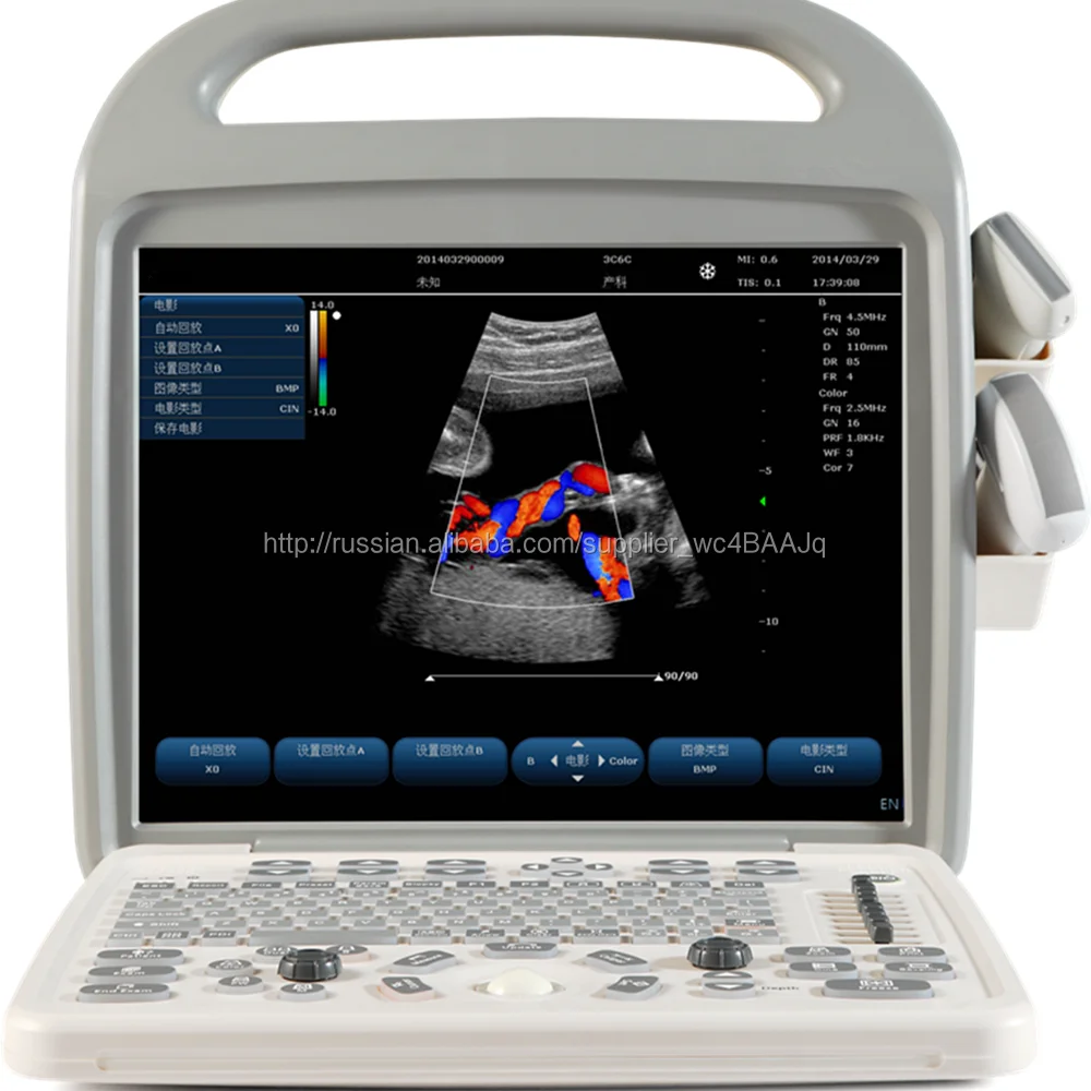 Портативный цвет ультразвуковая оборудование с конвексный датчик