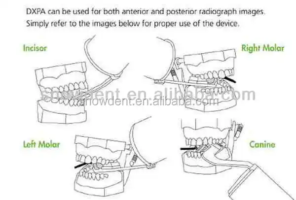 Dental supply X-ray Sensor holder/ sensor positioning holder