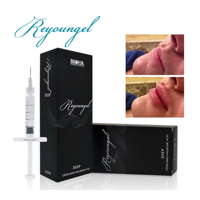 
Hot sale cross linked hyaluronic acid buy injectable dermal fillers Deep 2ml/1ml 