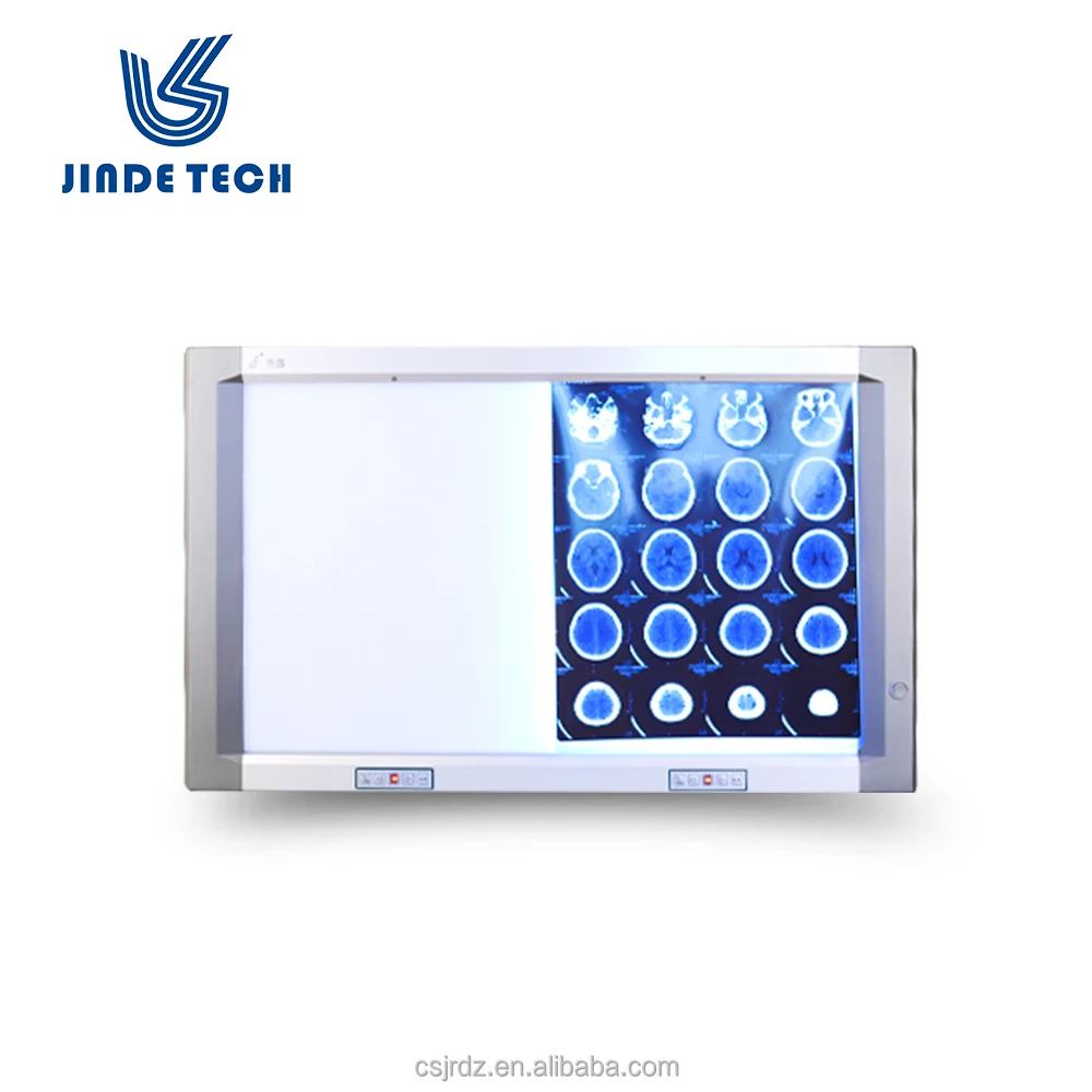 
Film viewer(medical)/x ray films negatoscope hot sell 