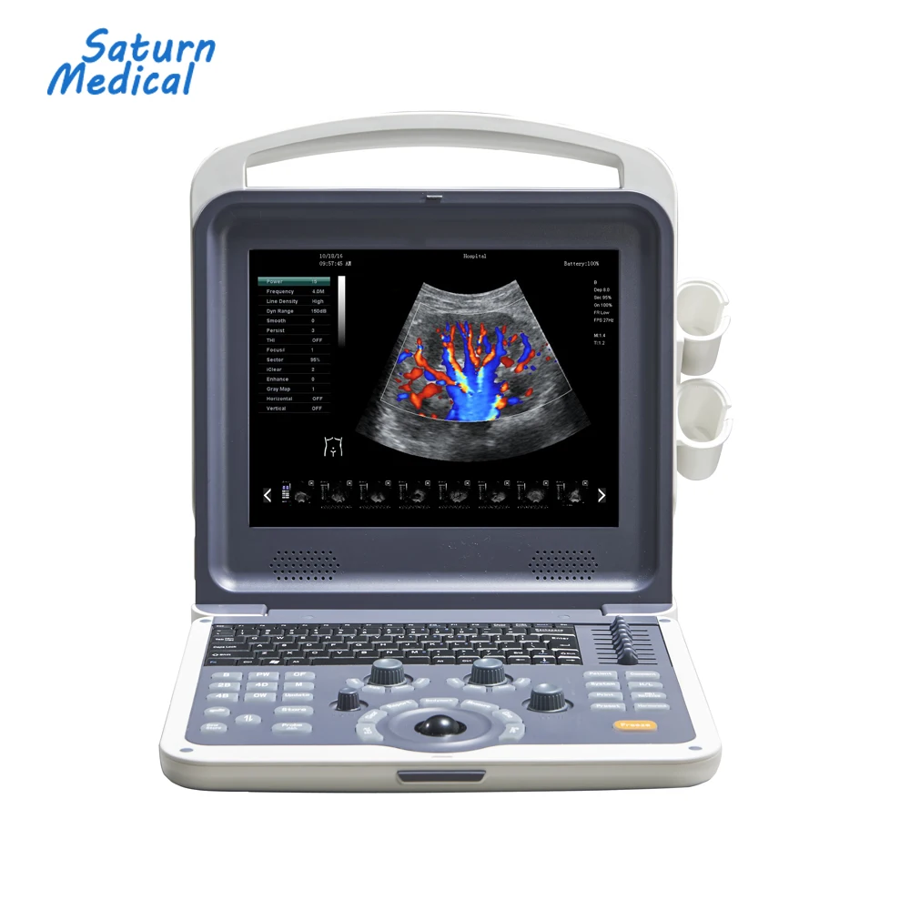 Manufacture price 4d portable color doppler ultrasound
