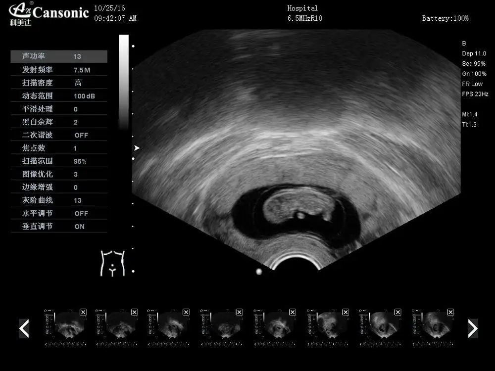 Manufacture price 4d portable color doppler ultrasound
