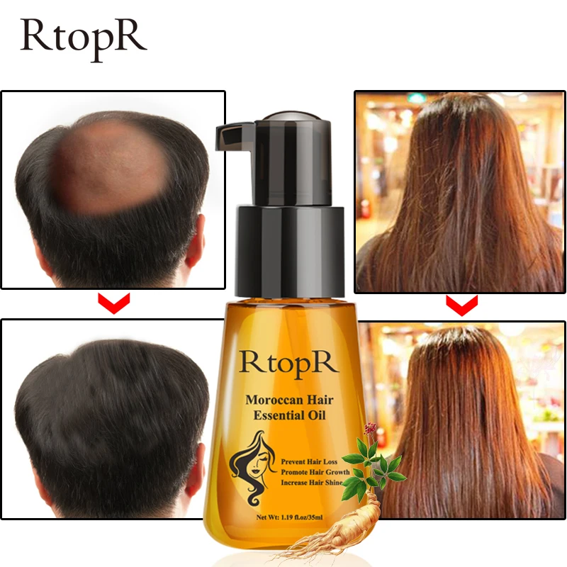 Moroccan Prevent Hair Loss Product Hair Growth Essential Oil Easy To Carry Hair Care Nursing 35ml Both male and female can use