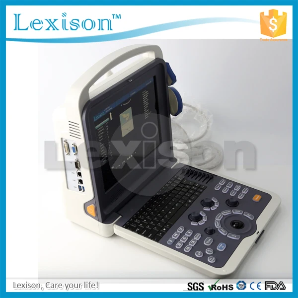 
Cardiac Portable Ultrasound 4D Ultrasound Scanner Color Doppler Ultrasound Machine Price 