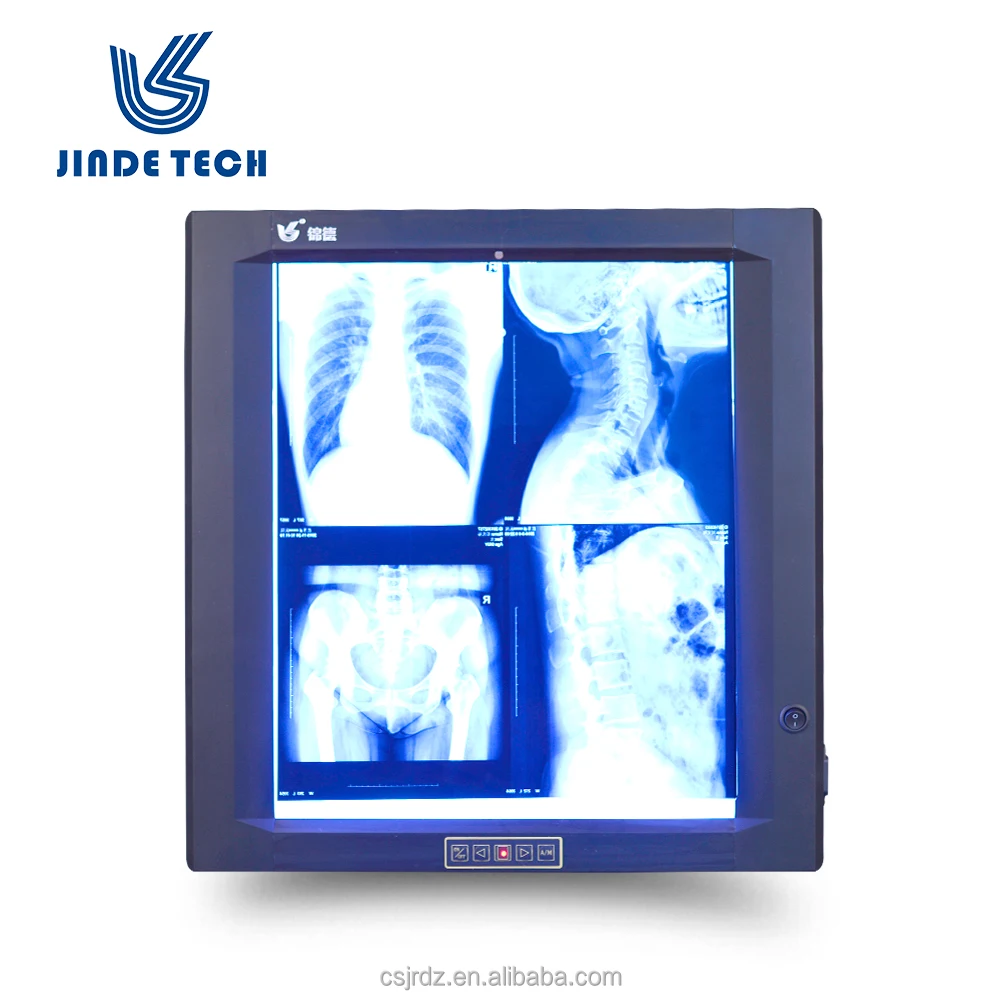 
Negatoscopio Single panel JD-01AIII high brightness X ray LED negatoscope 