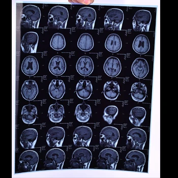 8*10 Inch Blue Base Inkjet Printing X Ray Medical Film