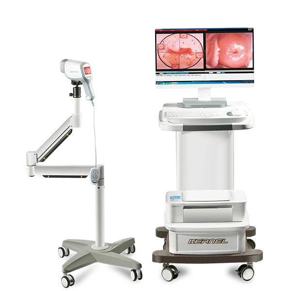 CE passed KN-2200A colposcopy machine digital video colposcope for gynecology examination