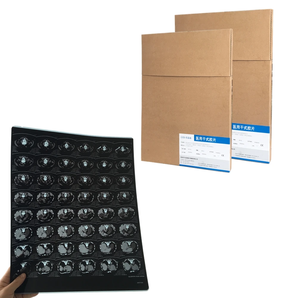 Waterproof Thermal  Printing Blue Sensitive Medical X-ray Film Same as agfa DT2B and DT5B 14x17