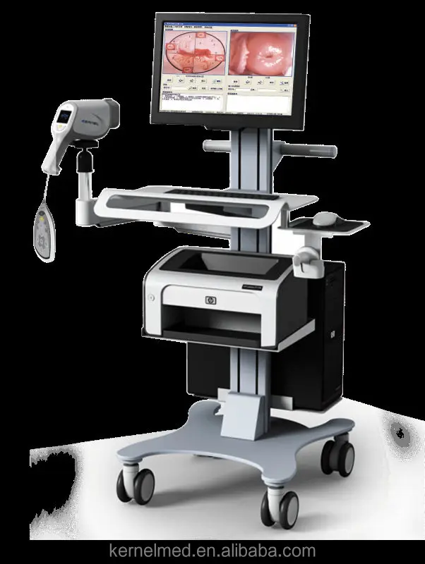 Digital HD Vagina Colposcope for Gynecology/Video Colposcope For Vagina KN-2200I