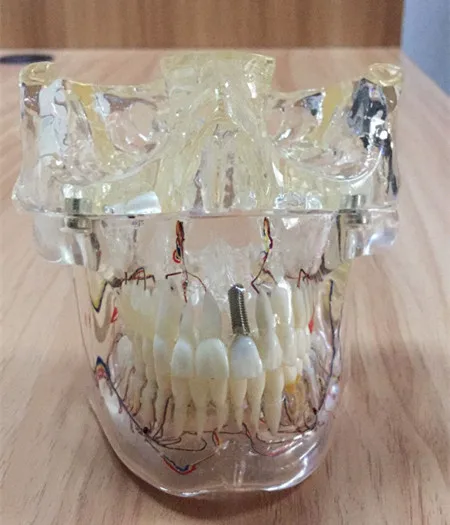 Стоматологическая Ортодонтическая модель зубов/демонстрационная модель стоматологической ортодонтии, обучающая, объясняющая модель для взрослых