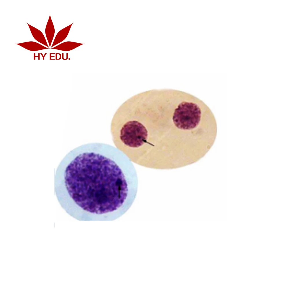 Fixed set high quality 14 pieces chromosome microscope prepared slides,human chromosome slides