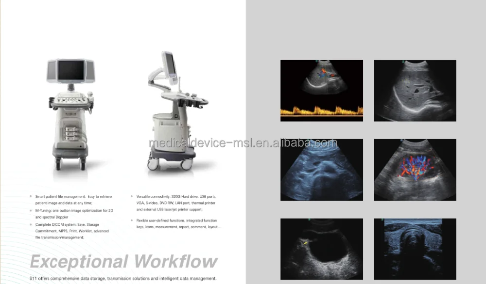 Ультразвуковой цветной допплер-сканер Sonoscape S11 с высоким разрешением echo