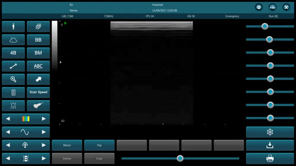 Low price High quality portable tablet ultrasound probe USB interface convex and linear probe scanner