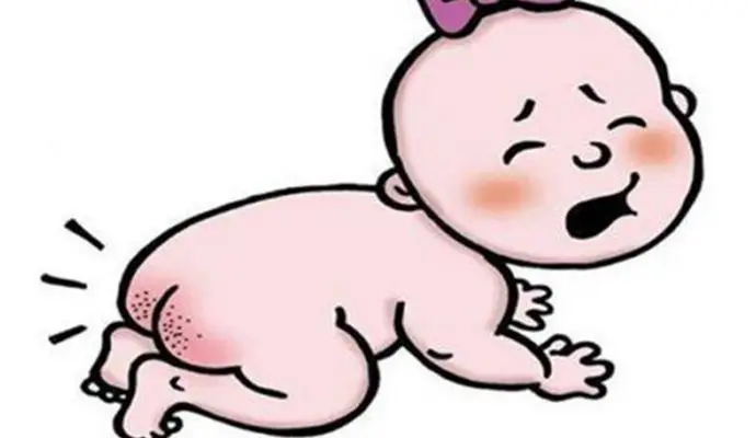 
sample available natural oil baby diaper nappy rash cream 