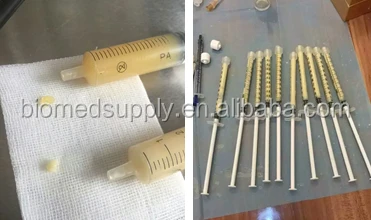 2021 New Advanced 4size ppp plasma prp machine