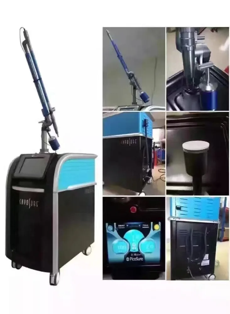 
picosecond laser tattoo removal / skin whitening / freckle removal 