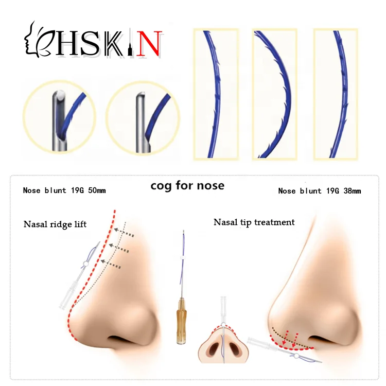 Korea Pdo/Pcl/ Plla Thread Nose blunt Face Lift Cog 3D/4D/6D Blunt Molding Mono