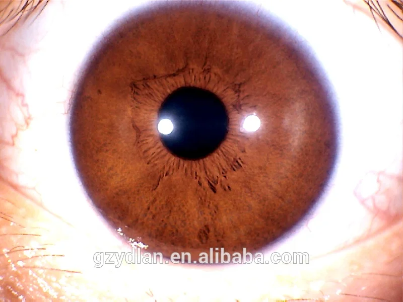 NEW 5.0 MP 4 LED/2 LED USB PRO software iris analyzer machine