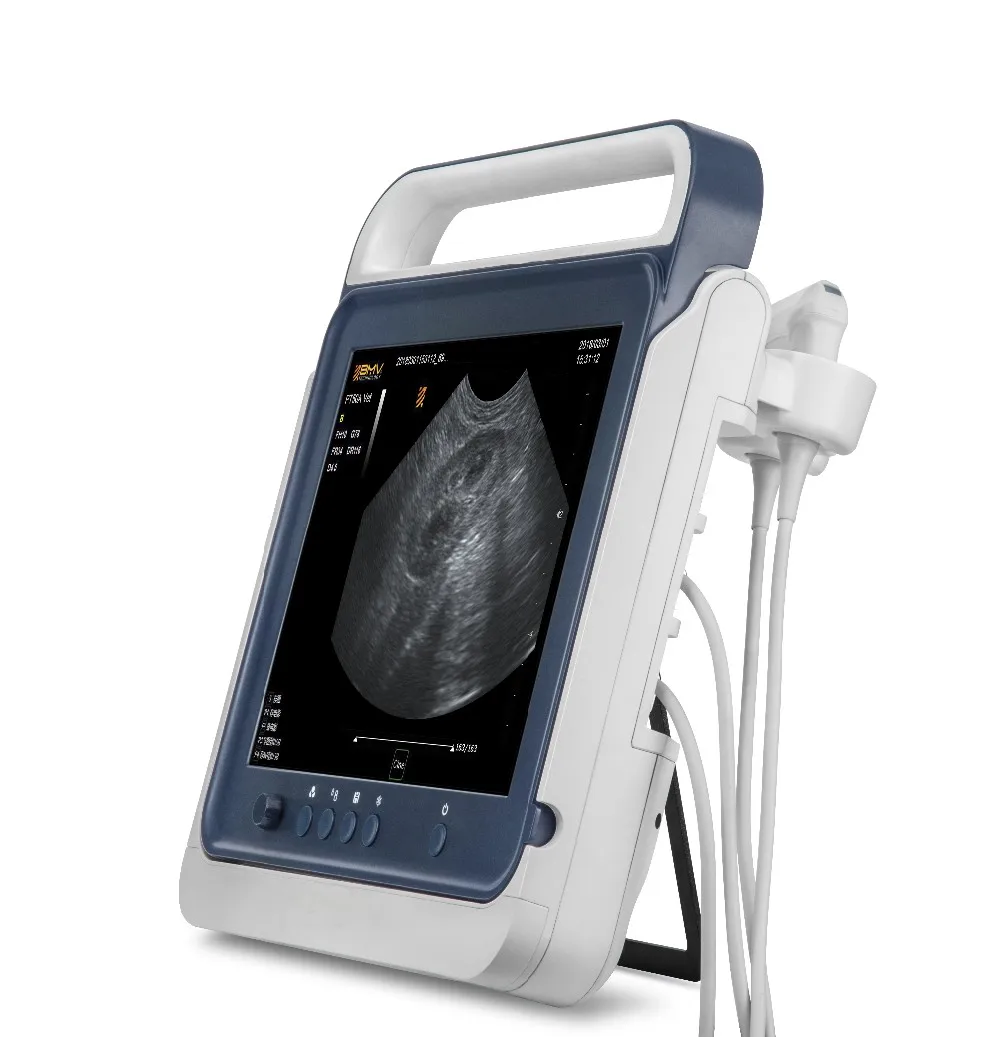 UTECH PT50CHand-carried color doppler diagnostic ultrasound system, hospital vascular doppler ultrasound